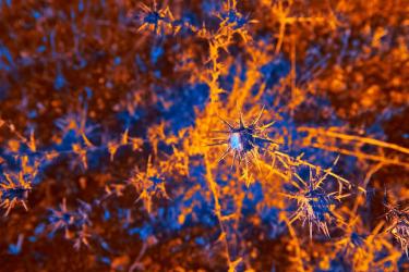 Scientists Reverse Anxiety by Rebalancing Brain Neurons